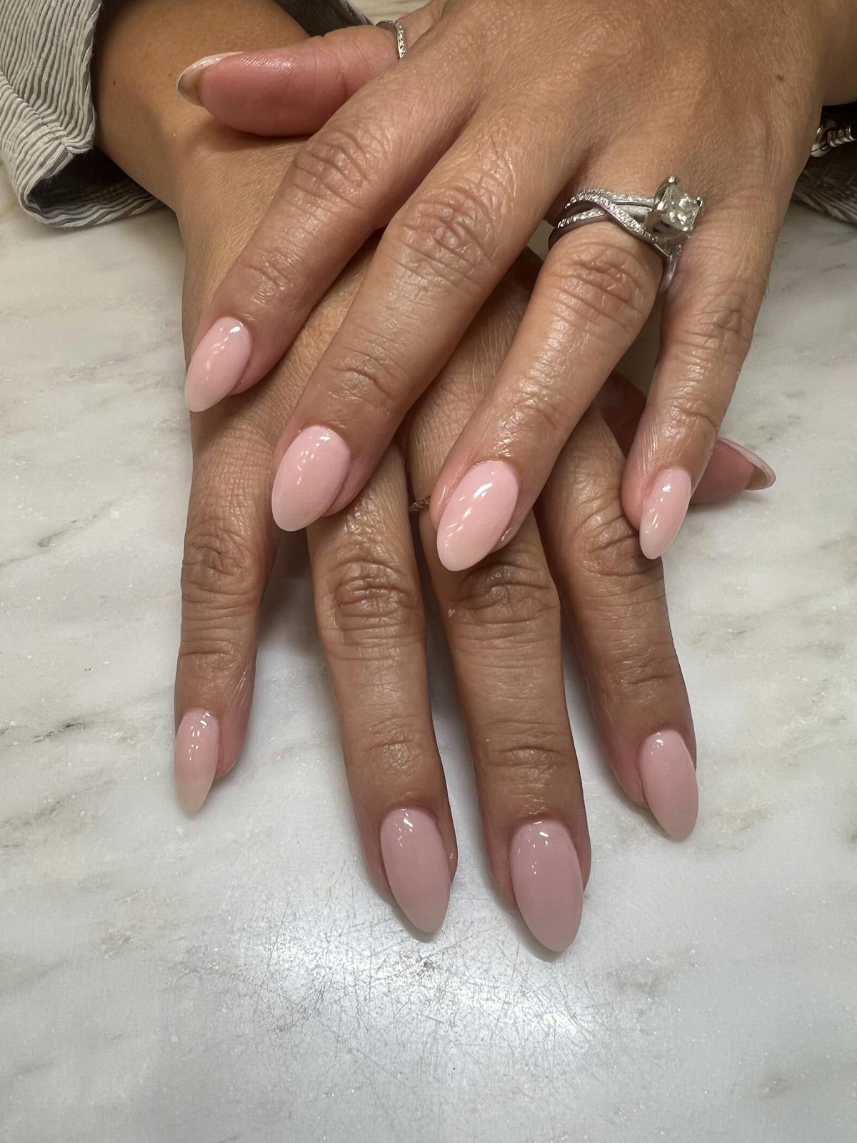 Signature Nail Treatments Before & After Gallery - Patient 145033987 - Image 1