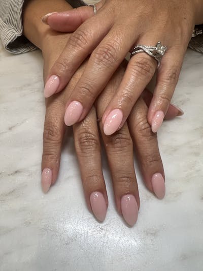 Signature Nail Treatments Before & After Gallery - Patient 145033987 - Image 1