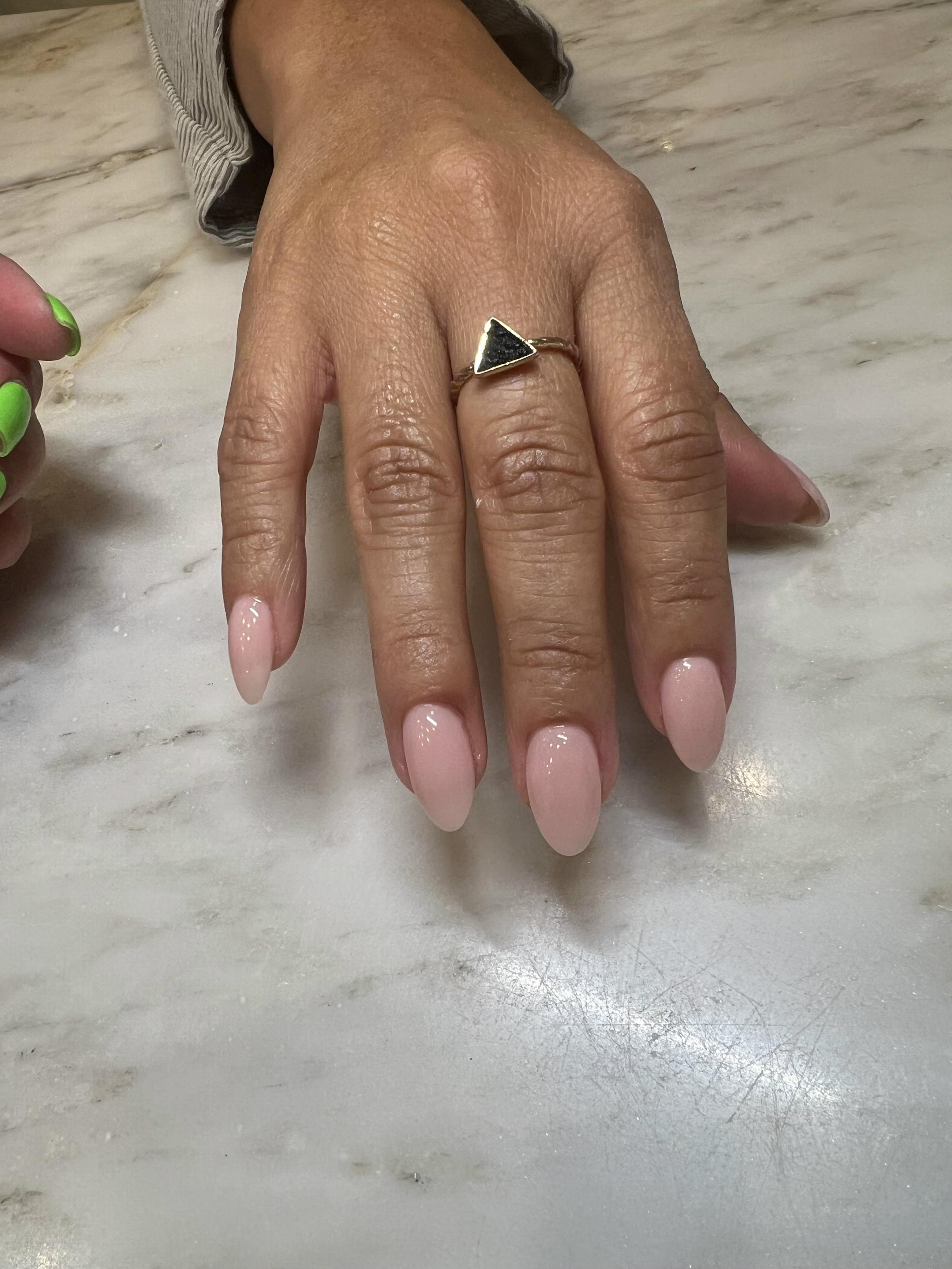Signature Nail Treatments Before & After Gallery - Patient 145033988 - Image 1