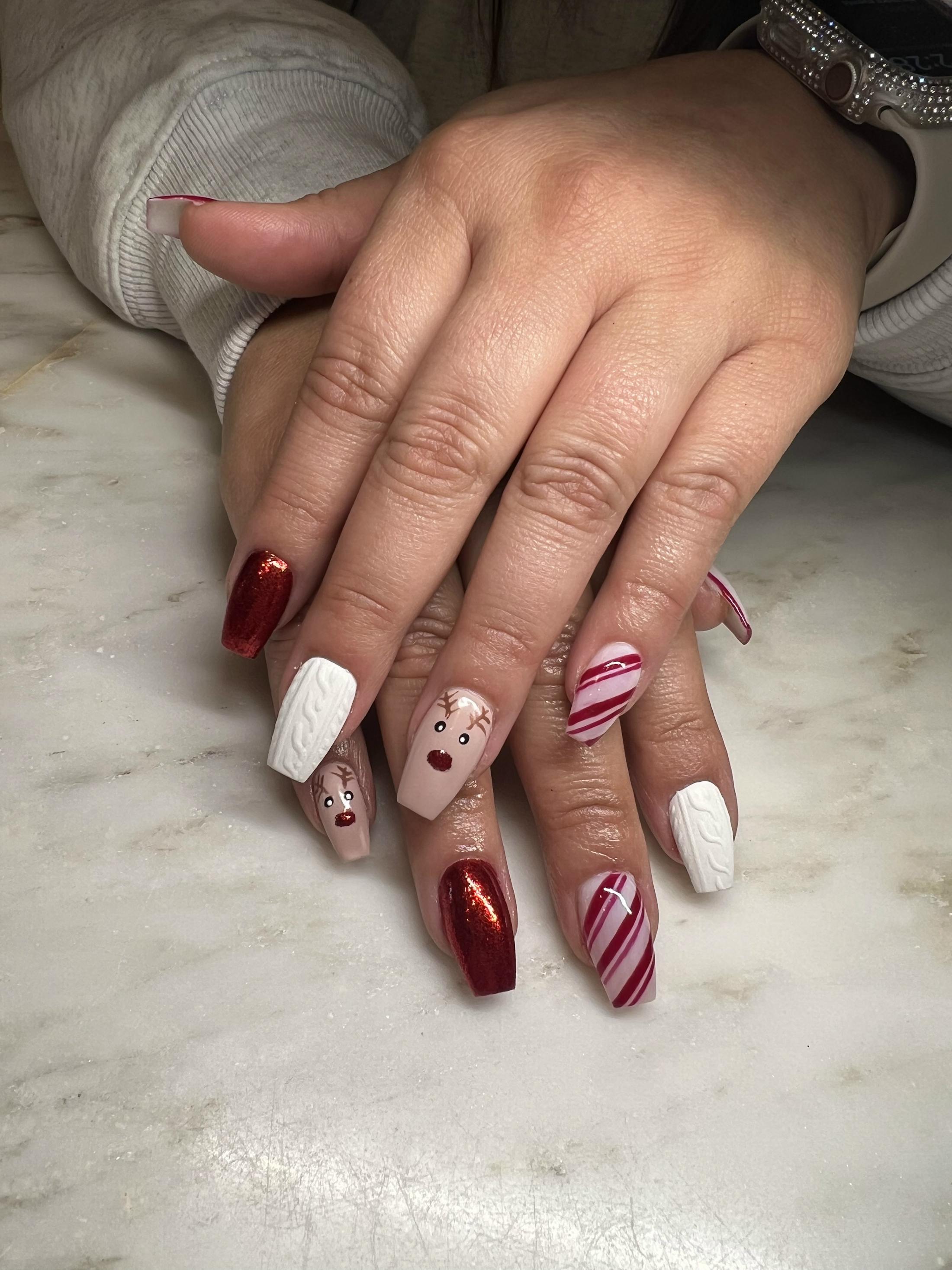 Signature Nail Treatments Before & After Gallery - Patient 145033990 - Image 1
