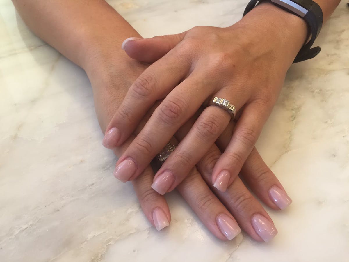 Signature Nail Treatments Before & After Gallery - Patient 145033992 - Image 1