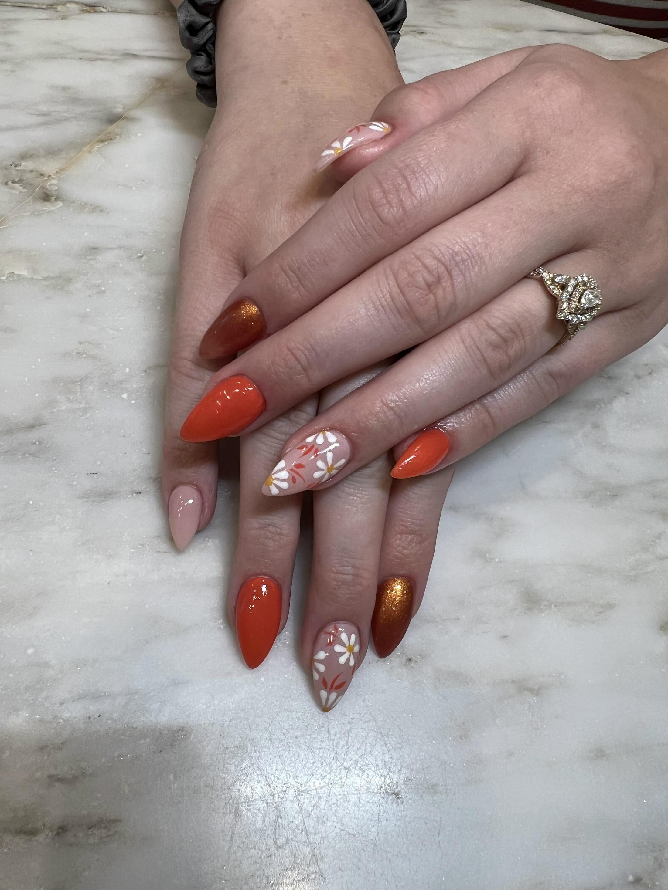 Signature Nail Treatments Before & After Gallery - Patient 145033993 - Image 1