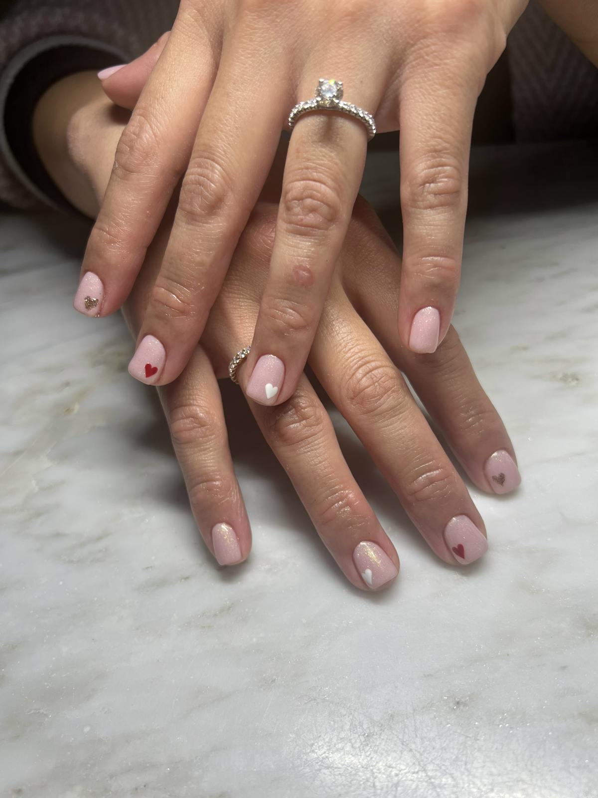 Signature Nail Treatments Before & After Gallery - Patient 145033994 - Image 1