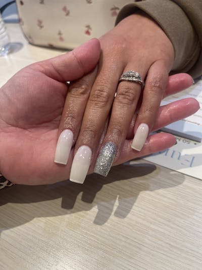 Signature Nail Treatments Before & After Gallery - Patient 145034029 - Image 1