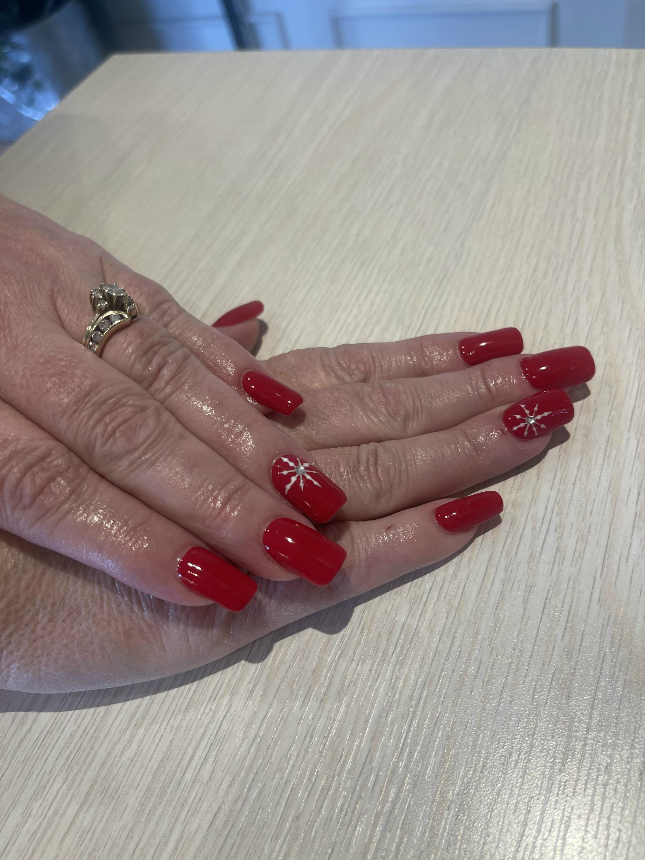 Signature Nail Treatments Before & After Gallery - Patient 145034028 - Image 1