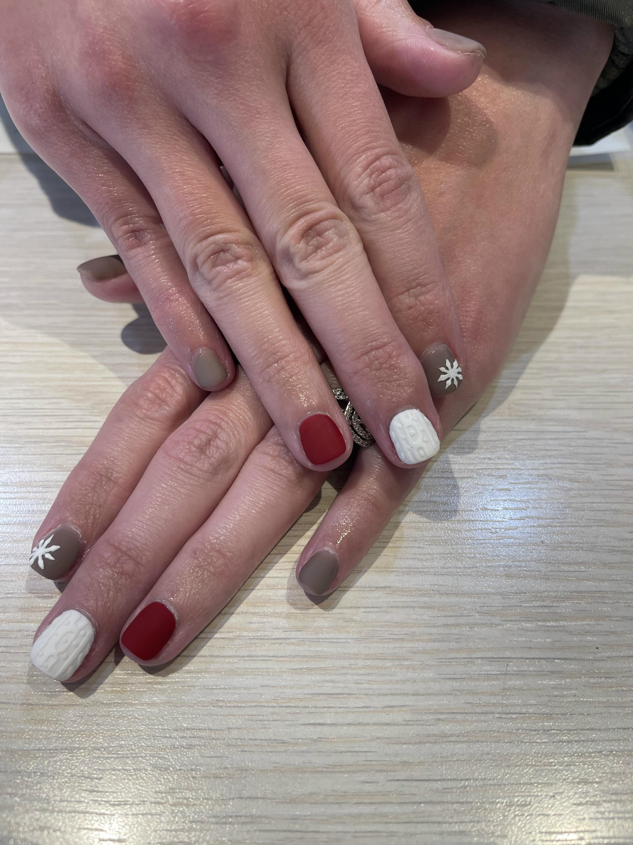 Signature Nail Treatments Before & After Gallery - Patient 145034027 - Image 1