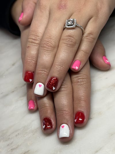 Signature Nail Treatments Before & After Gallery - Patient 322044 - Image 1