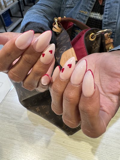 Signature Nail Treatments Before & After Gallery - Patient 232834 - Image 1