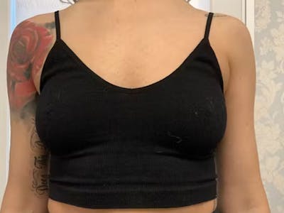 Before and After bust