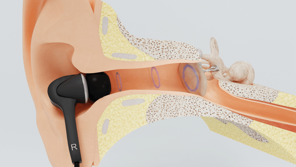 Diagram of earbud in an ear canal