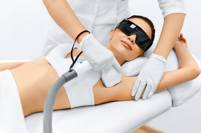 laser hair removal