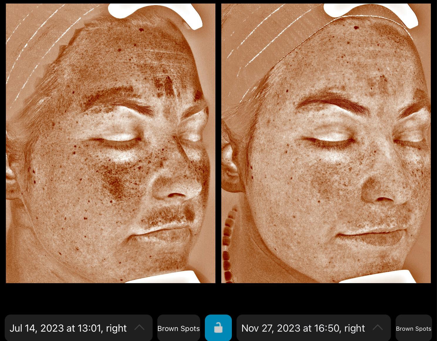 Skincare Before & After Gallery - Patient 218194 - Image 4