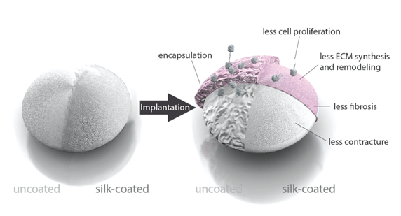 breast implant coating illustration