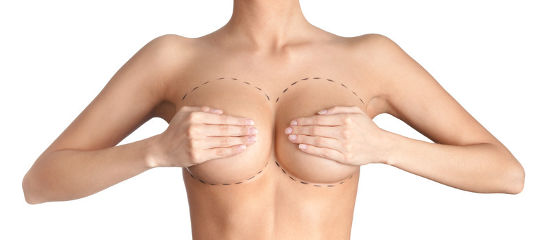 To Each Her Own: Different Breast Implant Styles To Suit Every Woman - Dr.  Olivia Hutchinson