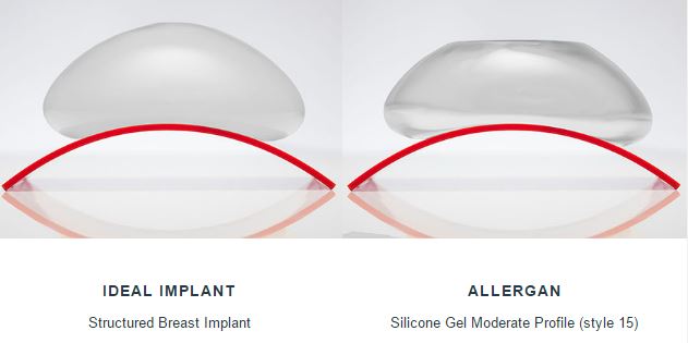 Ideal-AllerganSilicone- Implants