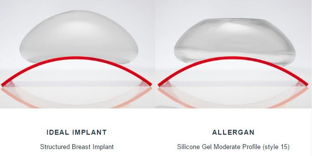 Gummy Bear” Breast Implants vs IDEAL IMPLANT