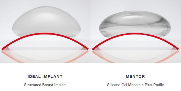 Ideal-MentorSilicone-Implants