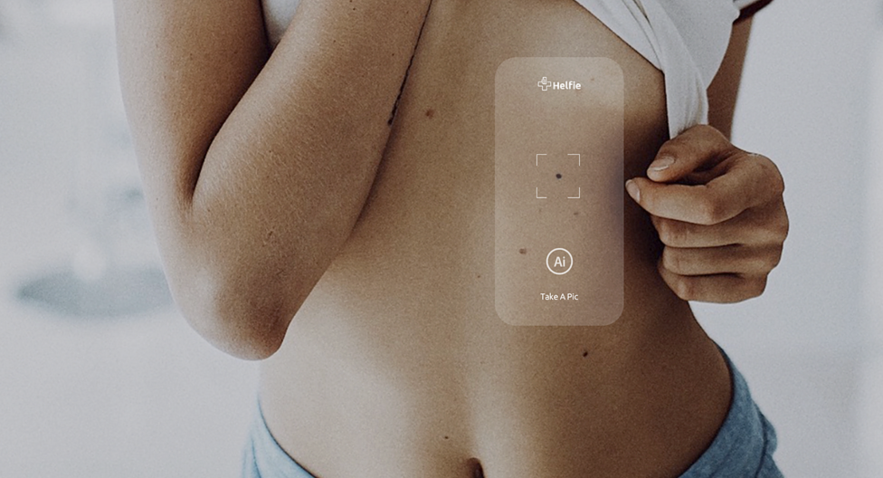Photo of mole on woman's torso
