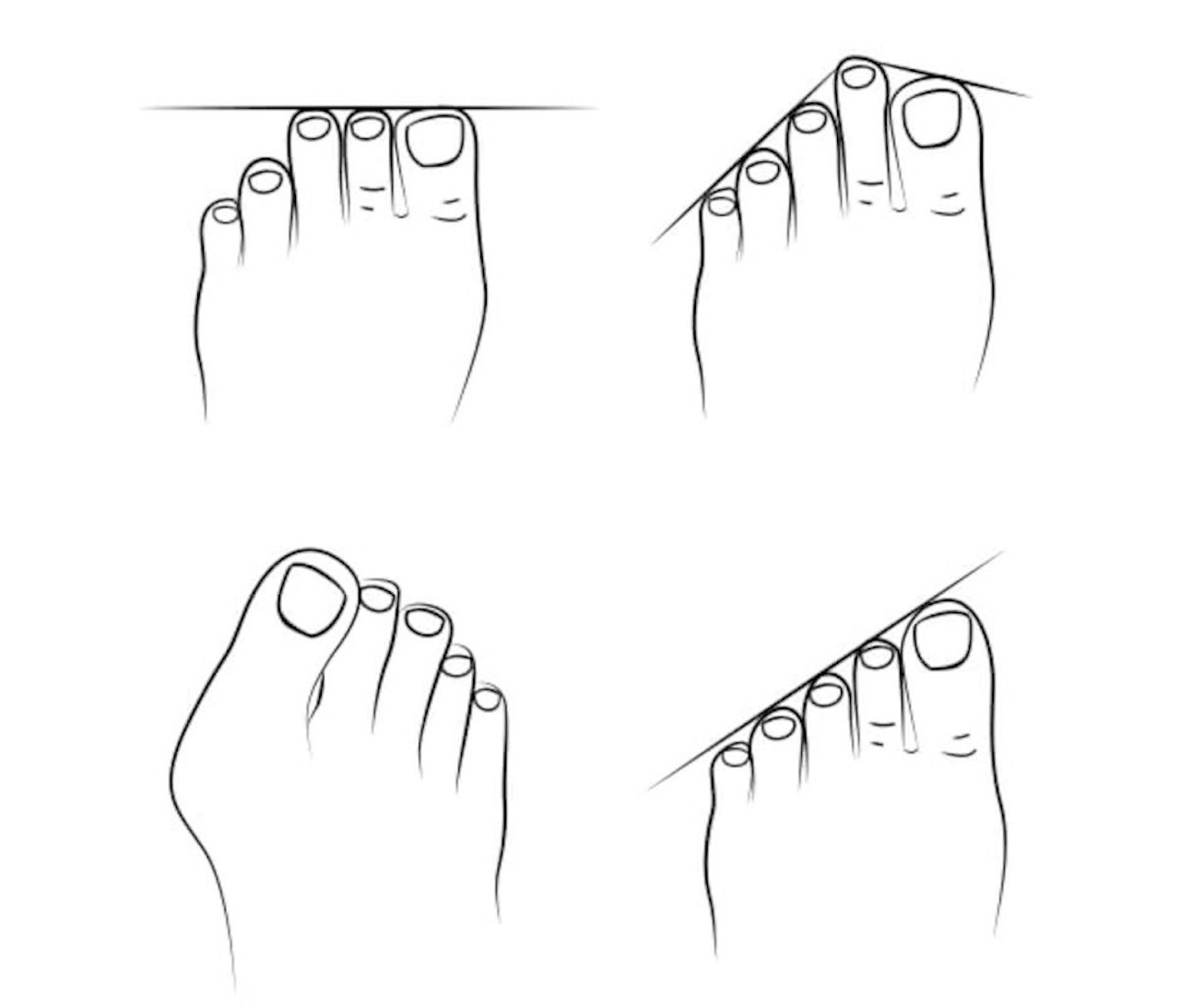 KLATRESKO OG FOTFORM: Sjekk ut hvilken fotform du har, og kanskje det hjelper deg på veien til å velge riktig klatresko. KLATRESKO OG FOTFORM: Sjekk ut hvilken fotform du har, og kanskje det hjelper deg på veien til å velge riktig klatresko.