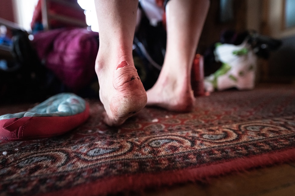 SOM PESTEN: Gnagsår kan ta knekken på en ellers fin tur i fjellet. Derfor er det viktig at du vet hva som skal gjøres for å unngå at de i det hele tatt kommer. Foto: Hans Kristian Krogh-Hanssen gnagsår på tur