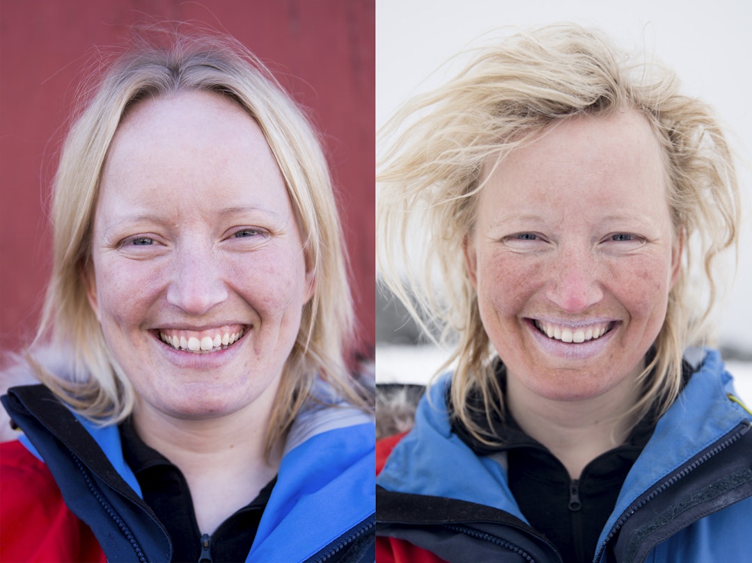 therese før etter therese før etter