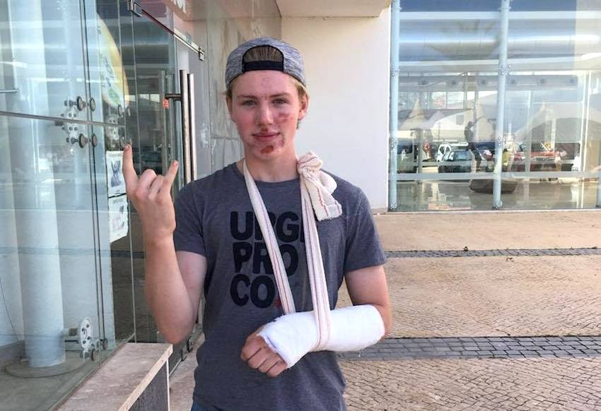 Andreas Øhrn får fem-seks uker på sidelinja etter at han tryna på tredje etappe i Enduro World Series på Madeira lørdag. Foto: Privat Andreas Øhrn - EWS Madeira 2017 - Foto Privat 850x582