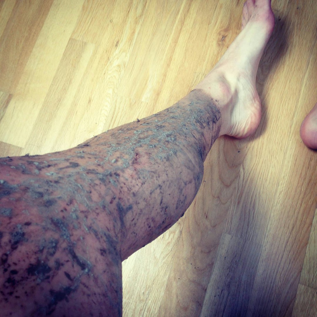 MØKKABEIN: Til tross for at beina ikke føltes bra, ble det en OK gjennomkjøring på Montebellorittet for Alexander. IMG_1601