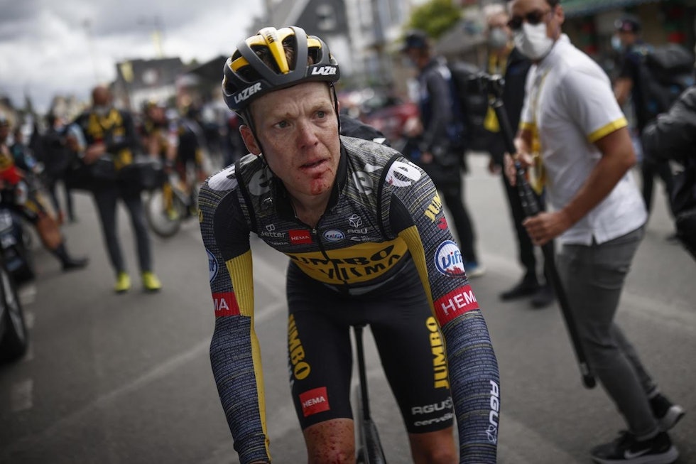 SKAMSLÅTT: Steven Kruijswijk kom til mål med blod overalt, og satt lenge i legebilen. Foto: Cor Vos. Steven-kruijswijk