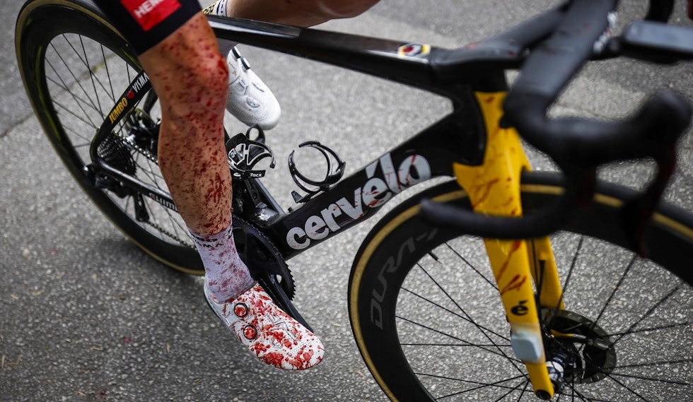 BLODIG: Steven Kruijswijk kom til mål full av blod på armer, ben og i ansiktet. Foto: Cor Vos. tour-de-france-velt-4