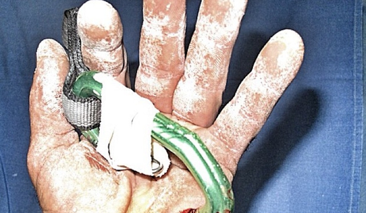 Hvilken ugang snuten på karabineren gjorde kan du se på hele bildet lenger nede i saken. Hvilken ugang snuten på karabineren gjorde kan du se på hele bildet lenger nede i saken.