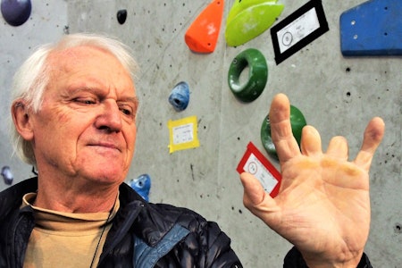 OMFATTENDE SKADE: Slik ser Ivar Walaas venstre hånd ut 23 år etter ulykken. Langfingeren og pekefingeren ble amputert ved det innerste leddet. Lillefingeren ble knust og måtte avstives. Foto: Iver Gjelstenli  OMFATTENDE SKADE: Slik ser Ivar Walaas venstre hånd ut 23 år etter ulykken. Langfingeren og pekefingeren ble amputert ved det innerste leddet. Lillefingeren ble knust og måtte avstives. Foto: Iver Gjelstenli