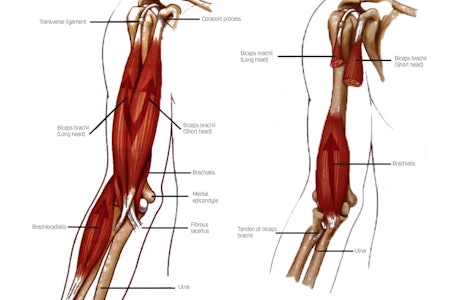 Vond albue: Illustrasjonen viser de tre primærfleksorene i albueleddet: M. biceps brachii, m.brachioradialis og m.brachialis. Legg merke til hvor Brachialis ligger plassert under bicepsmuskelen og hvordan denne lokalisasjonen stemmer overens med hvor de fleste angir å ha vondt når de har «Climber’s Elbow».