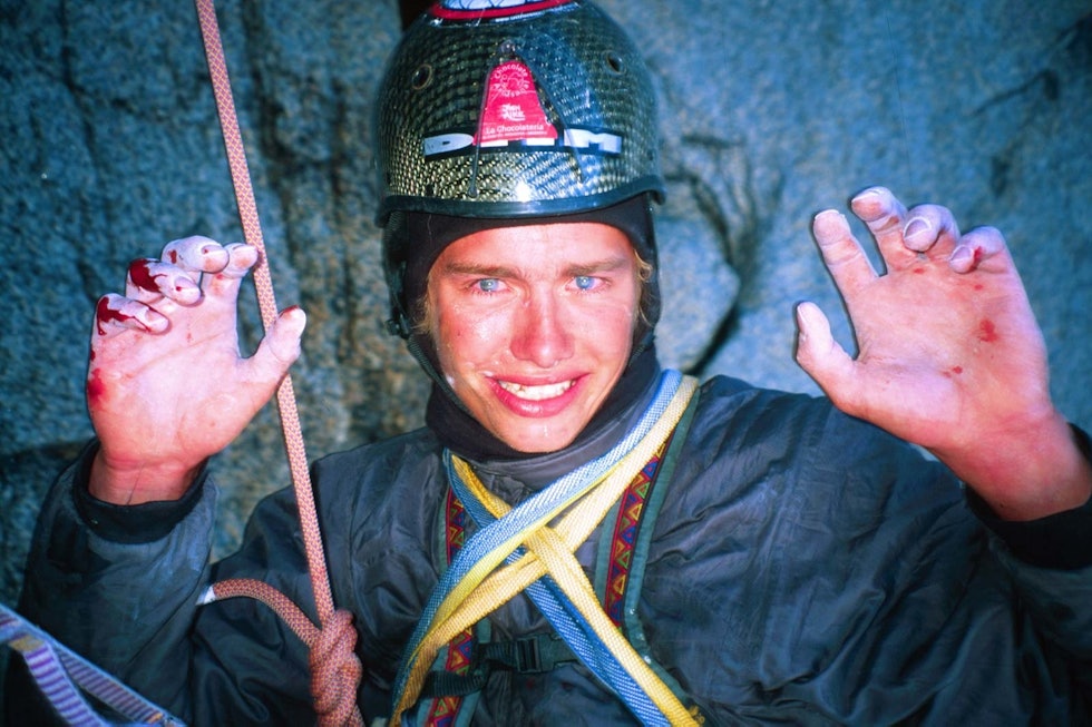 Skrekken: Leo innser at han ikke er udødelig, og er samtidig åndsnærværende nok til å be kompisen ta et bilde kort etter at han falt 15-20 meter og ødela ankelen, 300 meter opp på Østveggen av Cerro Torre, 16. februar 2002. Foto: Kevin Thaw Leo-Houlding-Klatring-3
