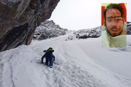 KVESTET: Den erfarne og dyktige frikjøreren Erik Finseth (innfelt) fikk seg en støkk i skredulykken i Troms sist helg. Det store bildet viser Steinar Aarberg på vei opp i terrenget hvor skredet løsnet, i flanken over renna. Begge foto: Eirik Finseth KVESTET: Den erfarne og dyktige frikjøreren Erik Finseth (innfelt) fikk seg en støkk i skredulykken i Troms sist helg. Det store bildet viser Steinar Aarberg på vei opp i terrenget hvor skredet løsnet, i flanken over renna. Begge foto: Eirik Finseth