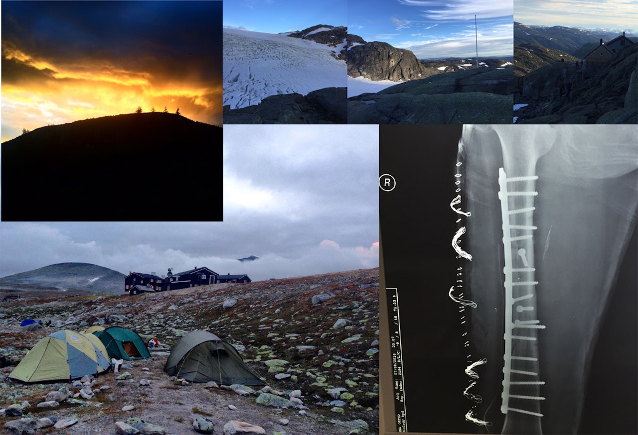 HELGENS BILDER: Både dramatikk på sykestua, telt, isbreer og solnedganger ble knipsa i helga. HELGENS BILDER: Både dramatikk på sykestua, telt, isbreer og solnedganger ble knipsa i helga.