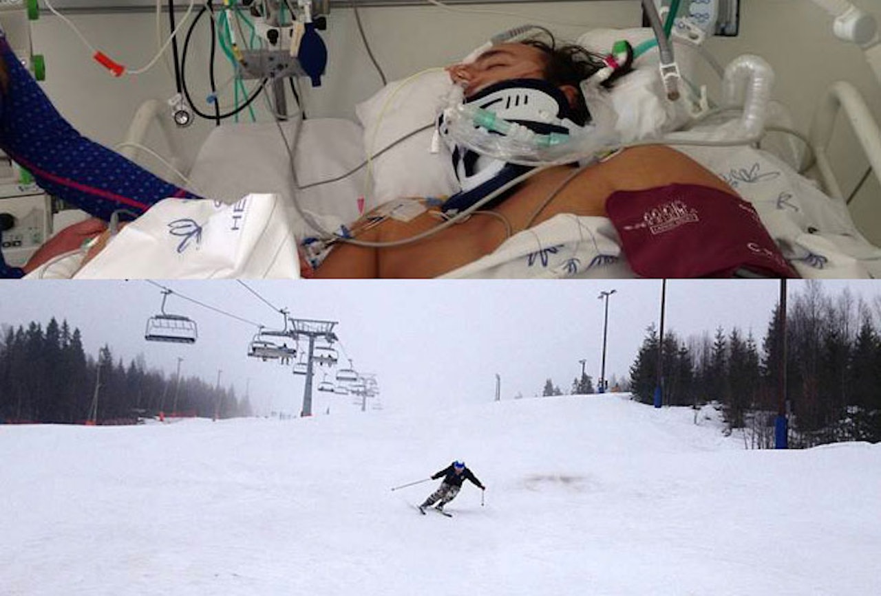 ETT ÅR MELLOM: På dagen ett år etter den alvorlige ulykken var Pål Magnus tilbake på ski. Bildene over er tatt med ett års mellomrom. Foto: Privat