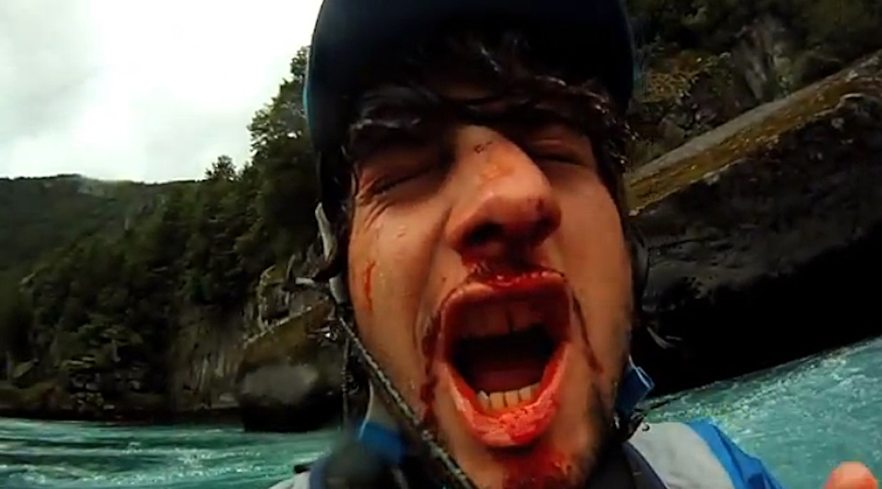 NESEBRUDD: Aniol Serrasolses har knekt nesa. Det er ikke så rart med tanke på størrelsen på fossene de setter utfor. NESEBRUDD: Aniol Serrasolses har knekt nesa. Det er ikke så rart med tanke på størrelsen på fossene de setter utfor.