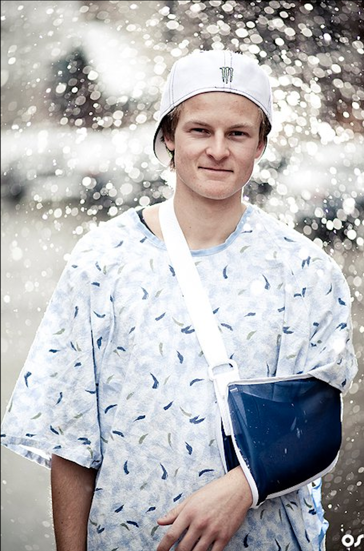 KRAGEBEINSBRUDD: Uheldige Gjermund Bråten brakk kragebeinet for 3. gang i natt. Foto: Olav Stubberud. KRAGEBEINSBRUDD: Uheldige Gjermund Bråten brakk kragebeinet for 3. gang i natt. Foto: Olav Stubberud.