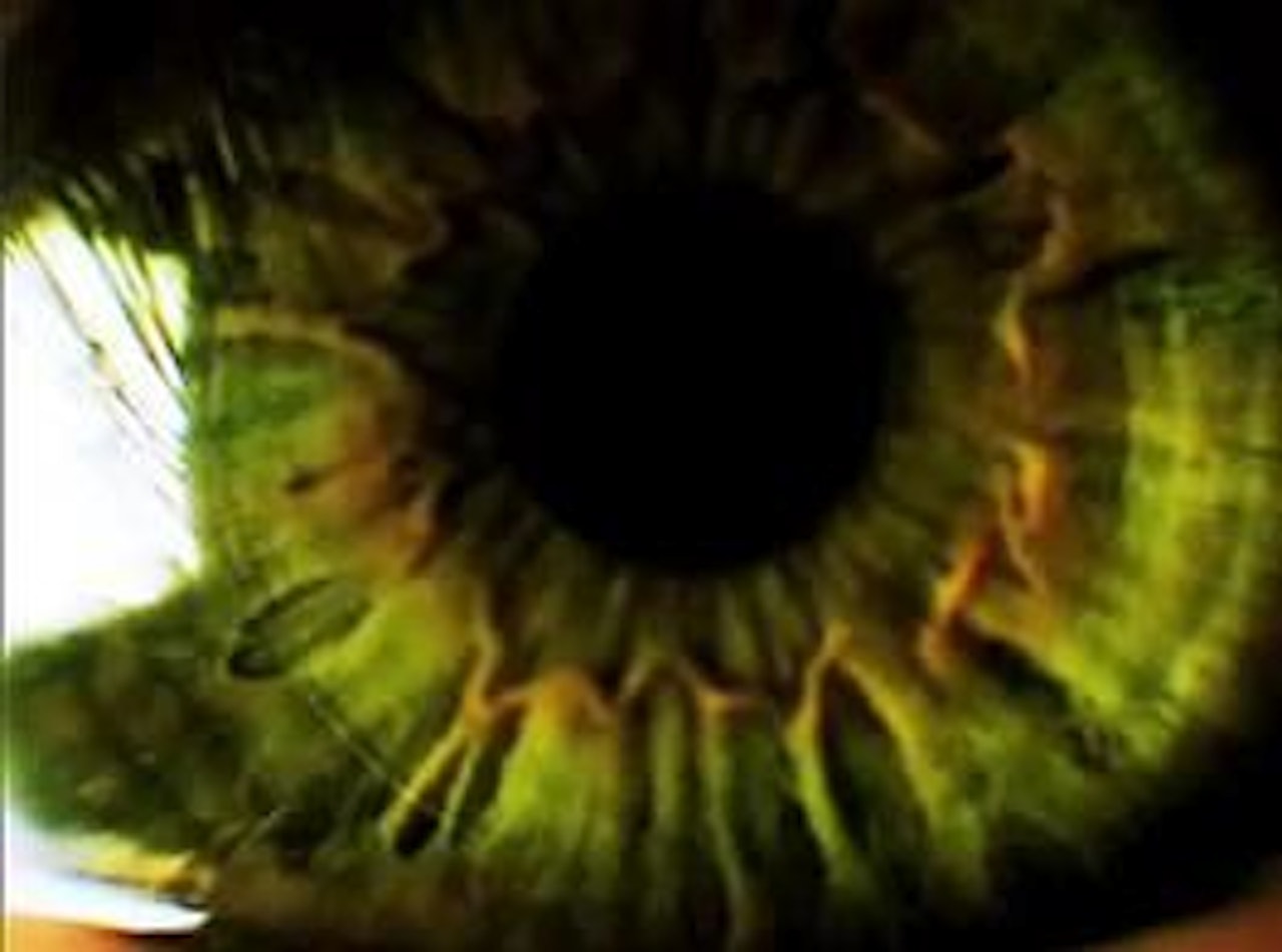 Mye godt for øyet i Optimistic? fra Absinthe Films Mye godt for øyet i Optimistic? fra Absinthe Films