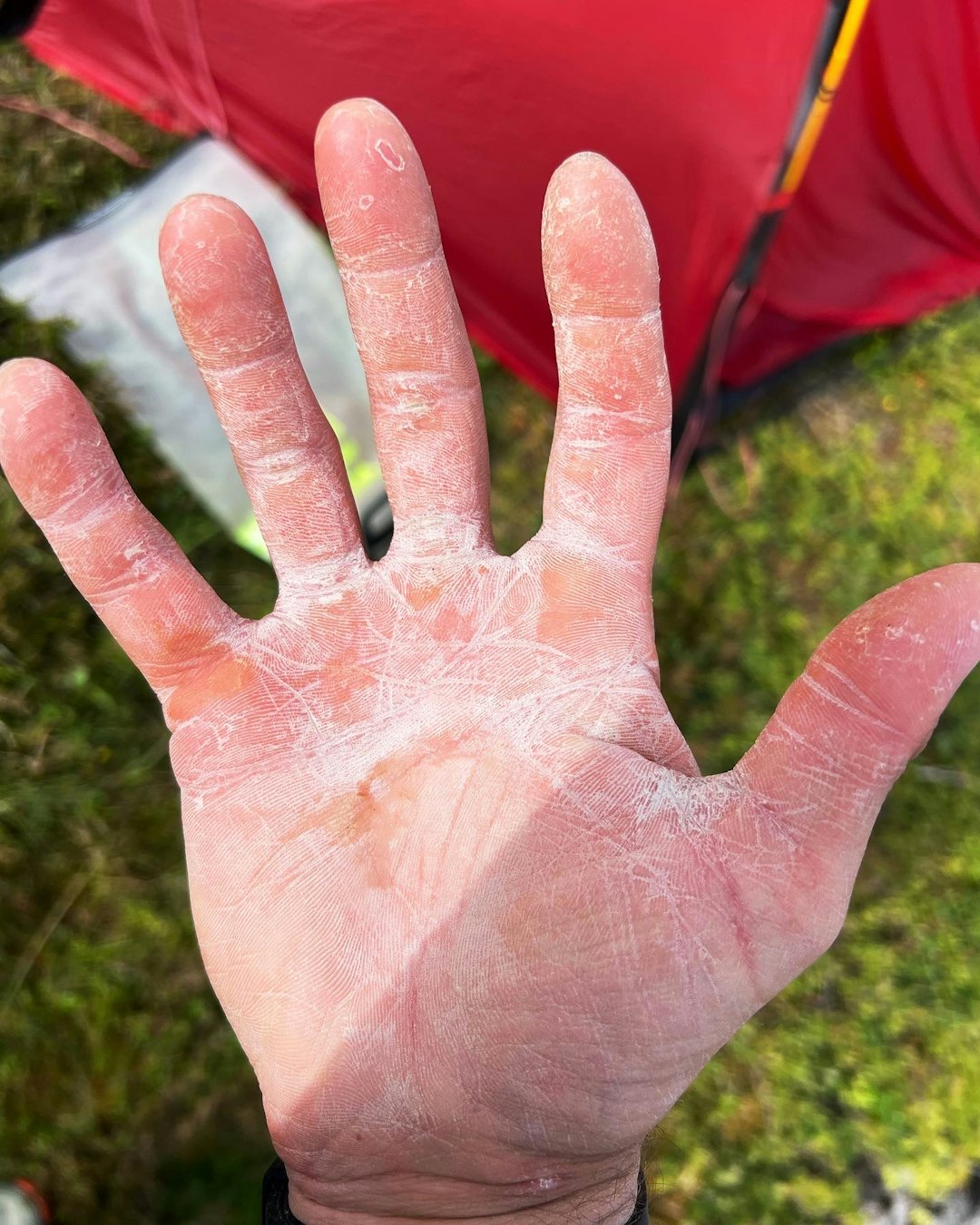 HINT AV HAV: Salte, herdete never etter lange dager på vannet. Dette bildet er fra Torghatten sør i Nordland etter en av de lengste padle-etappene. HINT AV HAV: Salte, herdete never etter lange dager på vannet. Dette bildet er fra Torghatten sør i Nordland etter en av de lengste padle-etappene.