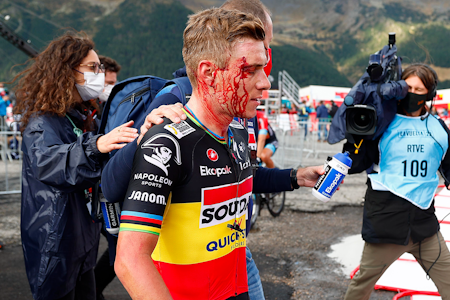 BLODIG: Remco Evenepoel pådro seg kutt i ansiktet i uhellet etter målgang. Foto: Cor Vos