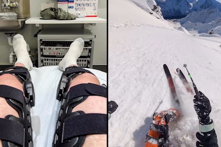 HØYE MÅL: Ekstreme disiplin og målrettet trening fikk Martin Andersen tilbake på ski i løpet av rekordtid. HØYE MÅL: Ekstreme disiplin og målrettet trening fikk Martin Andersen tilbake på ski i løpet av rekordtid.