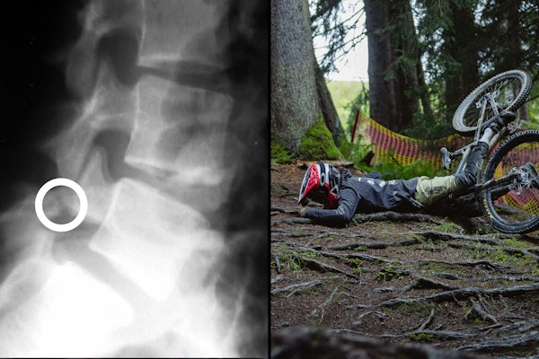 REALITETSSJEKK: Røntgenblinket varslet at 2025 først ville handle om tålmodighet for 14 år gamle Tess Van Weerdhuizen. Foto: Monica Gasbichler / @mediamoni REALITETSSJEKK: Røntgenblinket varslet at 2025 først ville handle om tålmodighet for 14 år gamle Tess Van Weerdhuizen. Foto: Monica Gasbichler / @mediamoni