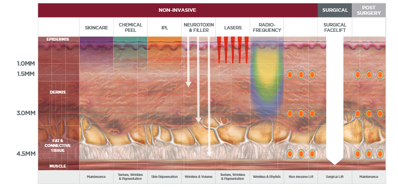 diagram of skin layers