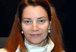 Eyelid Surgery Patient 71702036 Before & Afters