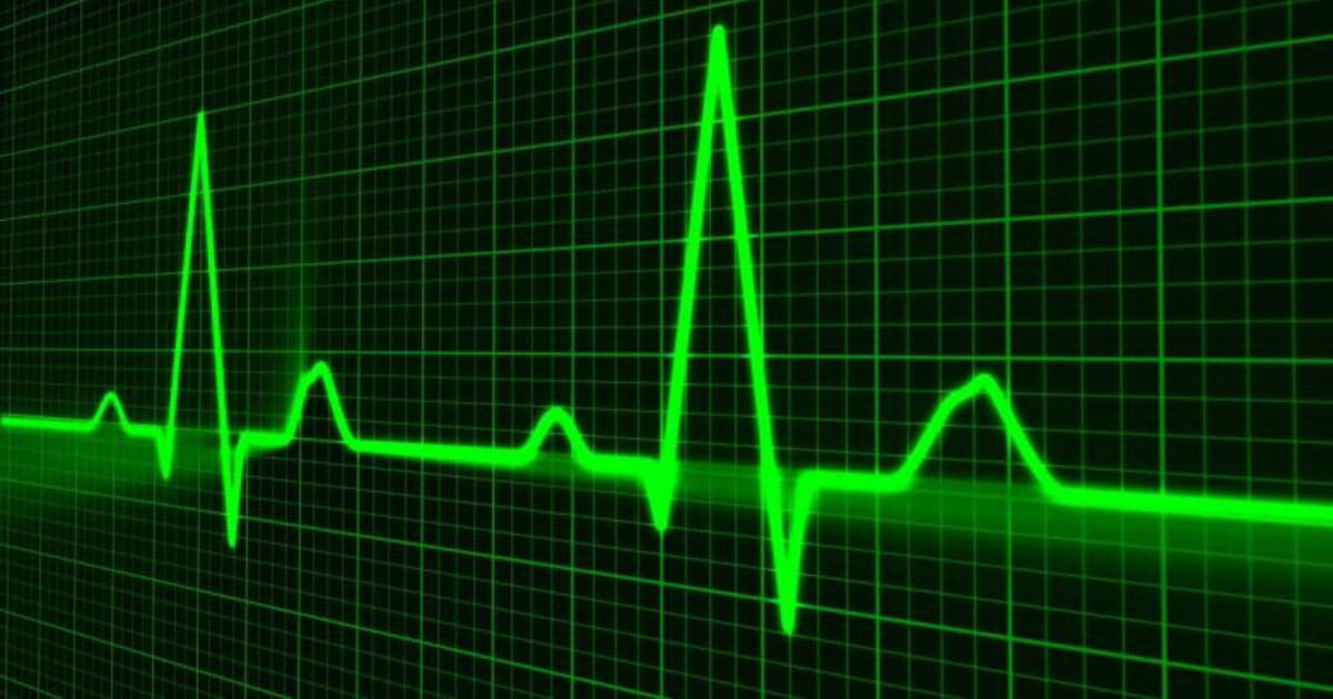 A Bond Bloodbath is Spiking Heart Rates