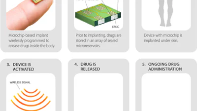 Op afstand bestuurbare chip zorgt voor 16 jaar anticonceptie