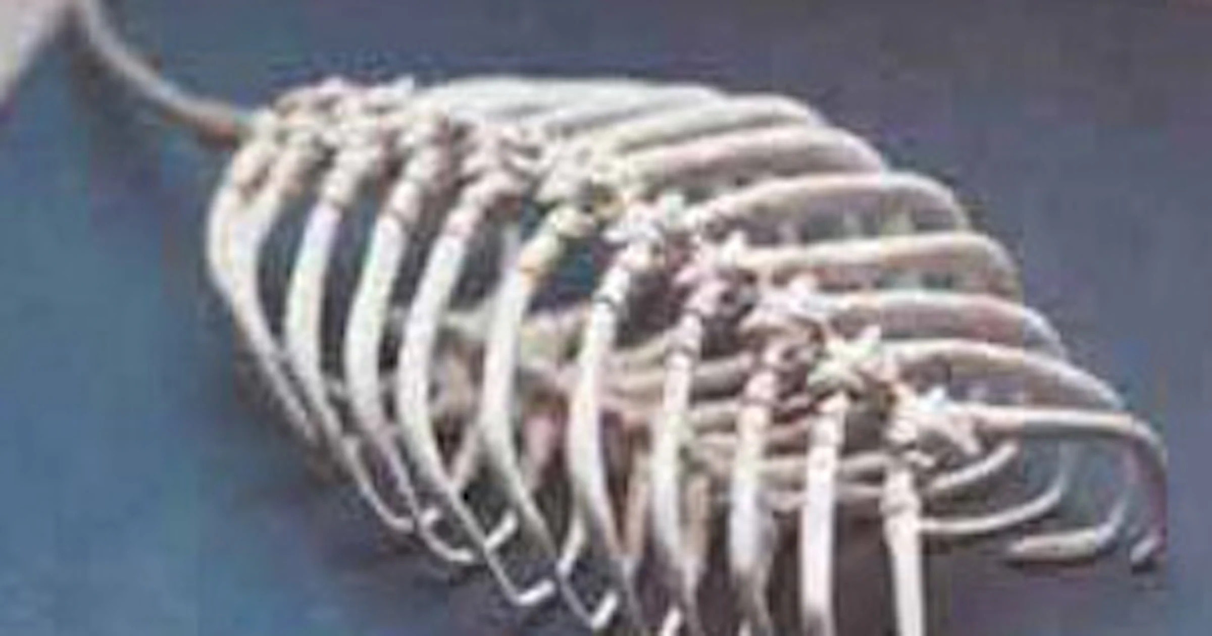 Mouse Rage Syndrom nieuwste computer-ziekte