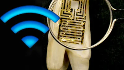Tand met wifi meet gezondheid