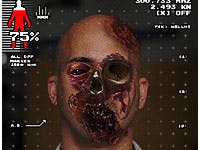 Zombiediagnose op je iPhone